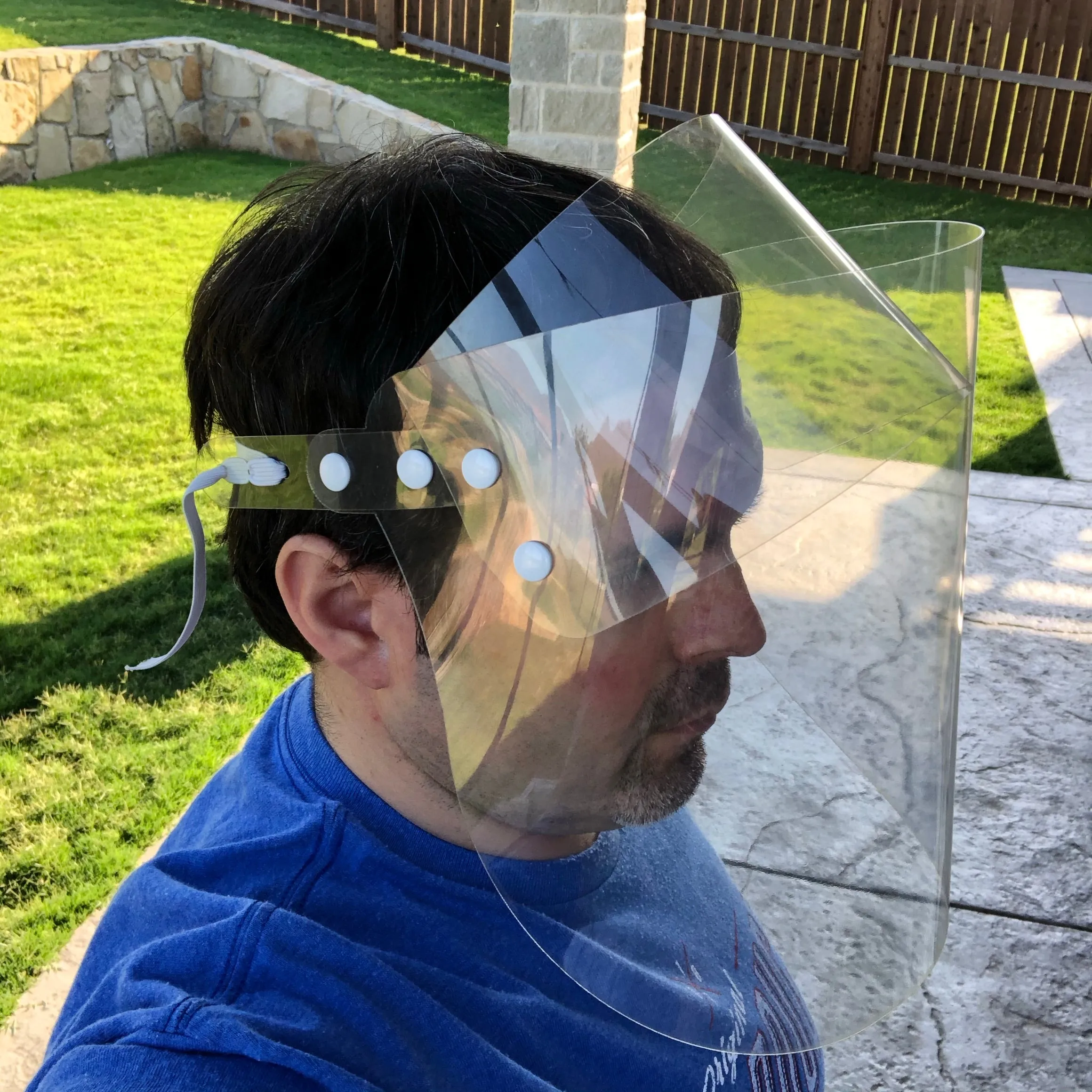 Dental Face Shield
